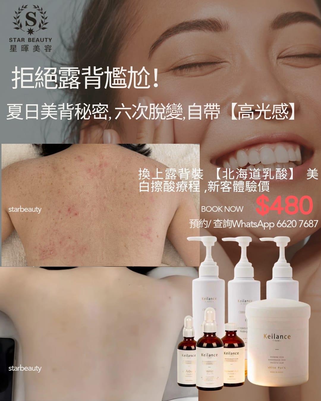 為什麼你需要【KEILANCE 北海道乳酸】？ 採用溫和高效配方，專為厚實的背部肌膚設計： &nbsp; &nbsp; 深層代謝： 精準軟化並溫和代謝頑固老廢角質。